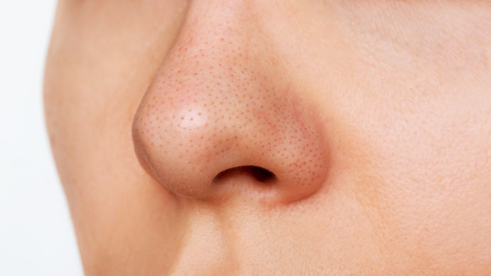 Apabila Anda juga bermasalah dengan pori-pori besar, cari produk non-comedogenic dengan pelembap humektan; Retinol juga bisa dipertimbangkan untuk pemakaian malam hari
