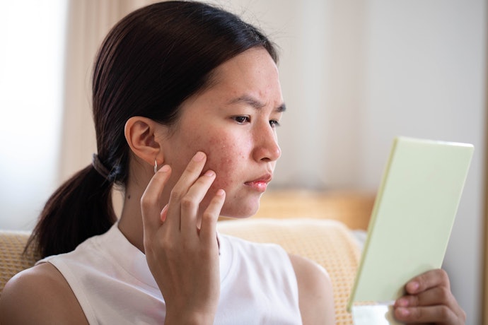 Pastikan essence mengandung bahan anti-inflamasi, seperti asam salisilat < 2%, Aloe vera, rose oil, atau bakuchiol untuk menenangkan kulit berjerawat