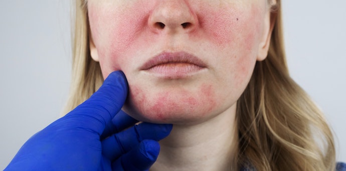 Kalau kulit Anda sensitif, prioritaskan toner lokal yang formulanya gentle dan mengandung soothing agent: Aloe vera, tea tree, niacinamide, dan Centella asiatica