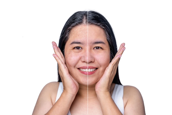 Untuk perawatan kulit sensitif pada usia lanjut, dapatkan essence dengan tambahan bahan antiaging, seperti retinol dan peptide