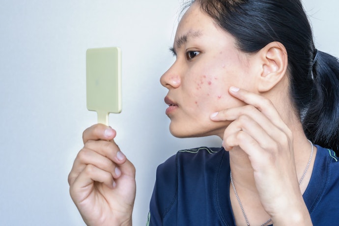 Untuk kulit berminyak atau berjerawat, pilih micellar water dengan salicylic acid