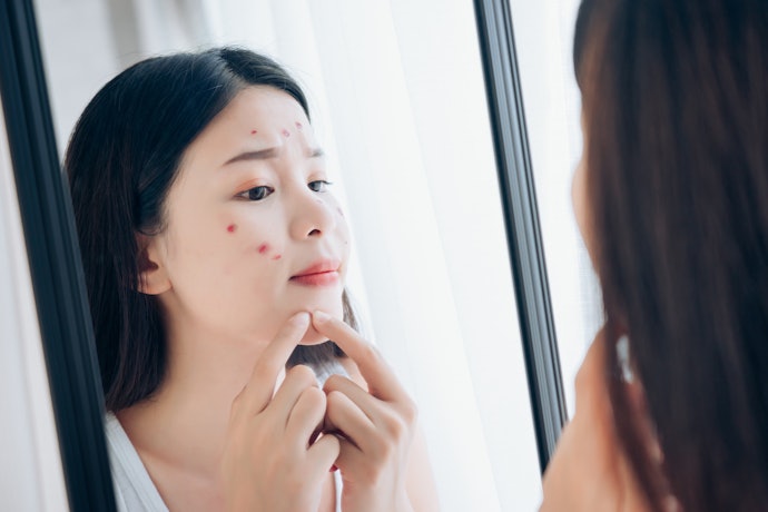 Sensitif atau jerawat meradang: Pilih physical sunscreen