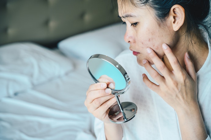 Salicylid acid: Untuk membasmi jerawat