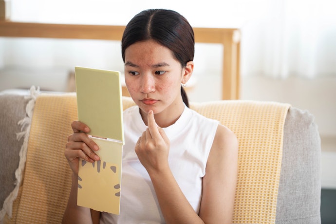 Namun, bila berjerawat, prioritaskan sunscreen chemical yang non-comedogenic