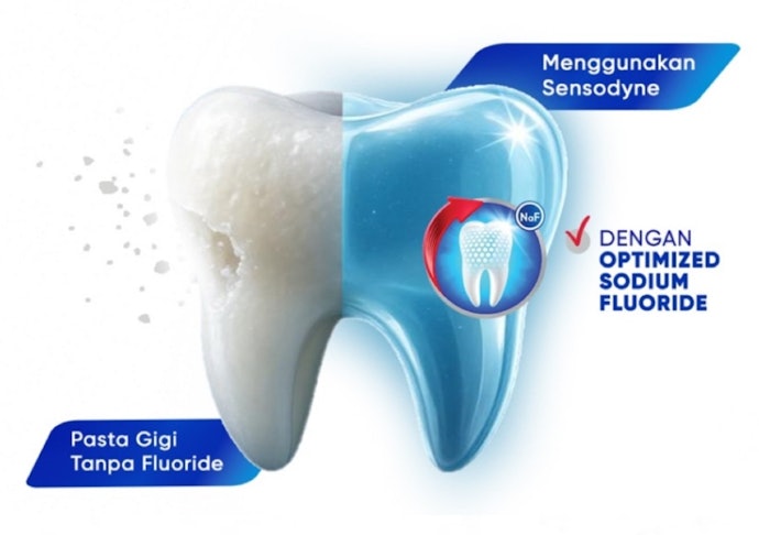 Untuk perbaikan gigi jangka panjang, pasta gigi sensitif tetap perlu mengandung fluoride