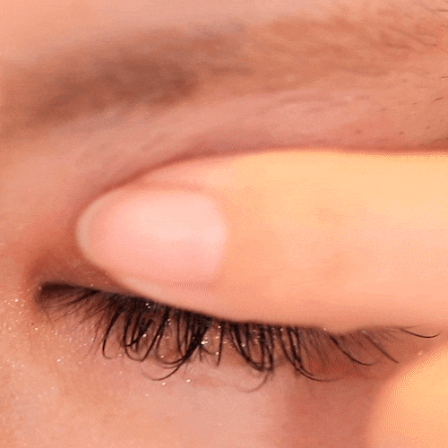 Hati-hati saat melepas eyelid tape