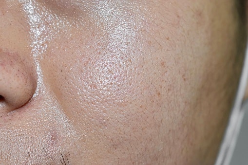 Bila tipe kulit Anda berminyak, kombinasi, atau sensitif, utamakan concealer liquid