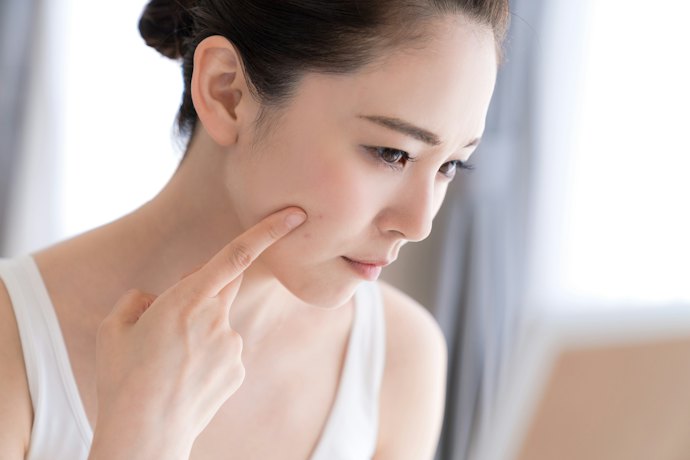 Untuk kulit yang berjerawat, pilih masker dengan kandungan salicylic acid atau glycolic acid