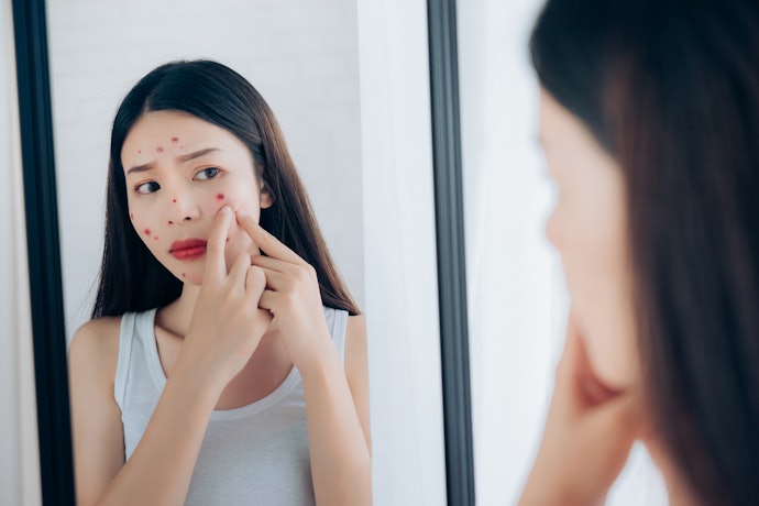 Bila kulit Anda berminyak dan cenderung berjerawat, temukan kombinasi dengan niacinamide