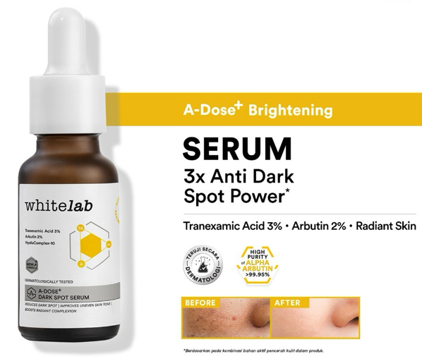 Untuk masalah pigmentasi yang membandel: Prioritaskan serum TXA dengan kombinasi pencerah, seperti licorice extract atau alpha arbutin