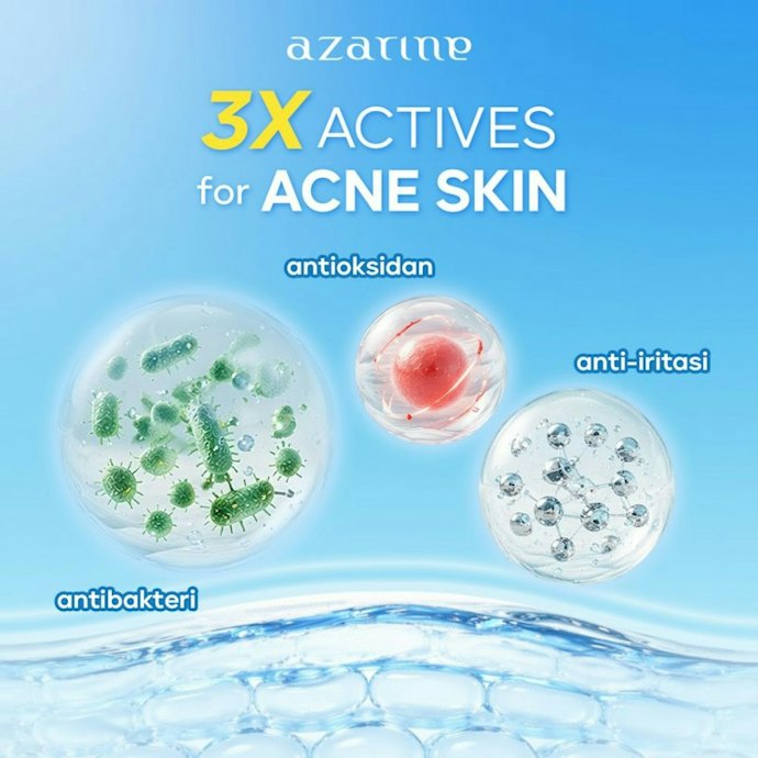 Moisturizer untuk kulit berjerawat dan sensitif: Pastikan ada tambahan antibakteri dan soothing agent