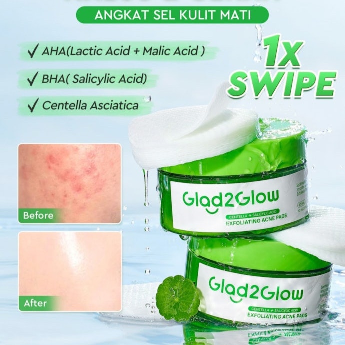 Jika kulit berminyak dan cenderung berjerawat, cari yang dilengkapi niacinamide dan salicylic acid