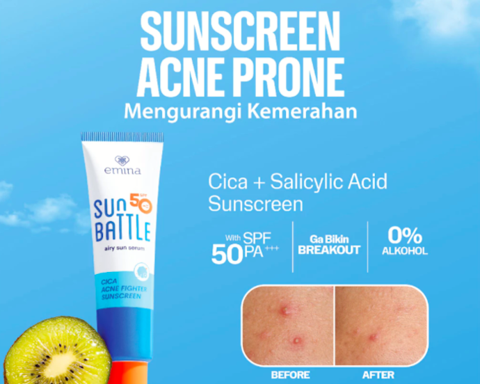 Kulit berjerawat yang meradang: Utamakan sunscreen dengan anti-acne seperti Centella asiatica