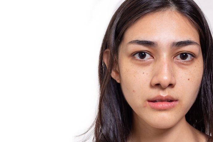 Kombinasi niacinamide dan glycolic acid: Mengeksfoliasi kulit sekaligus mencerahkan