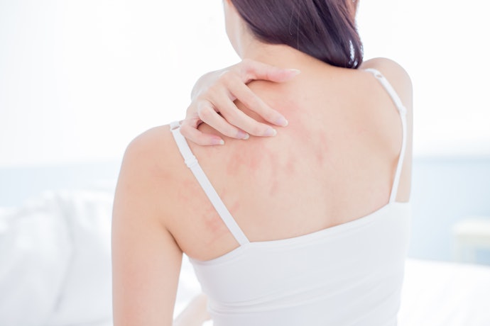 Untuk masalah scabies, pilih sabun belerang dengan persentase 10%