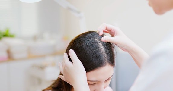 Kulit kepala kering: Lembapkan dengan glycerin, coconut oil, almond oil, atau Aloe vera