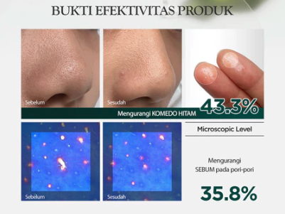 Cocok untuk perawatan kulit berjerawat: Ekstrak tea tree dan green tea