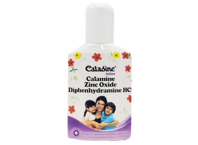Gatal karena keringat: Pilih bedak cair yang mengandung zinc oxide atau calamine