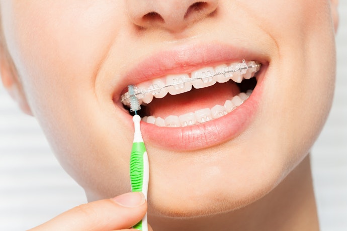 Interdental brush, mampu membersihkan sisa makanan pada celah kawat gigi