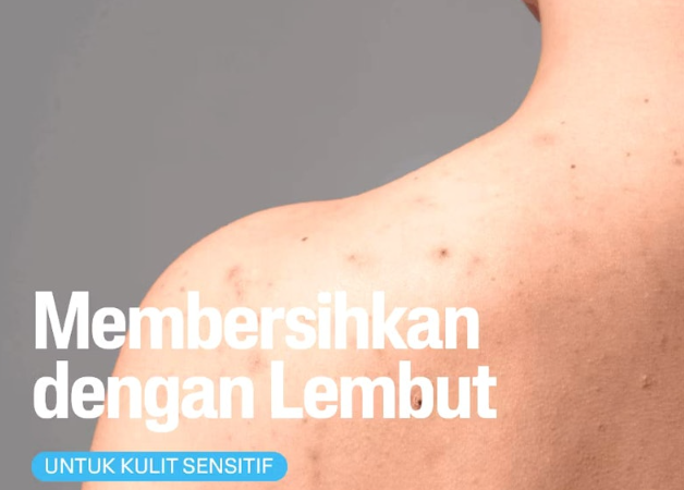 Namun, jika kulit Anda sensitif, pilih yang mengandung niacinamide dan allantoin; Hindari kandungan salicylic acid, sulfur, dan pewangi