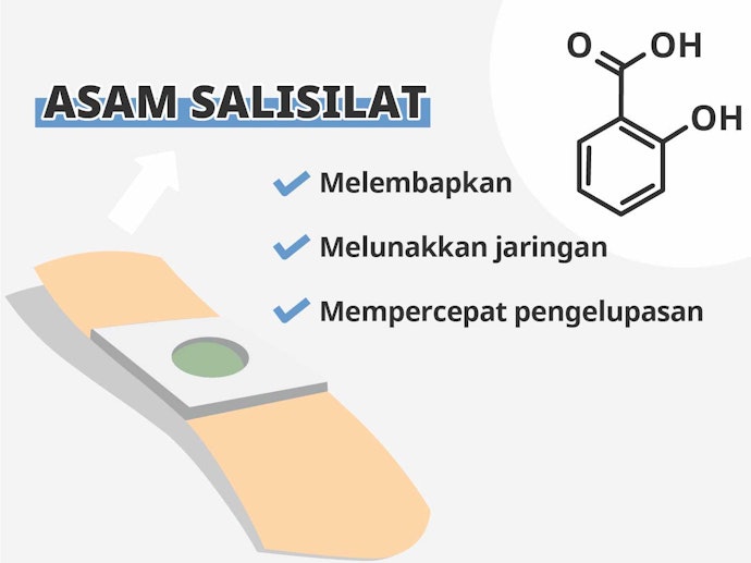 Asam salisilat, melunakkan mata ikan dan jaringan kulit di sekitarnya