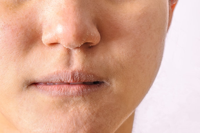 Jika kulit cenderung kering, pilih produk yang dilengkapi dengan pelembap seperti ceramide atau hyaluronic acid