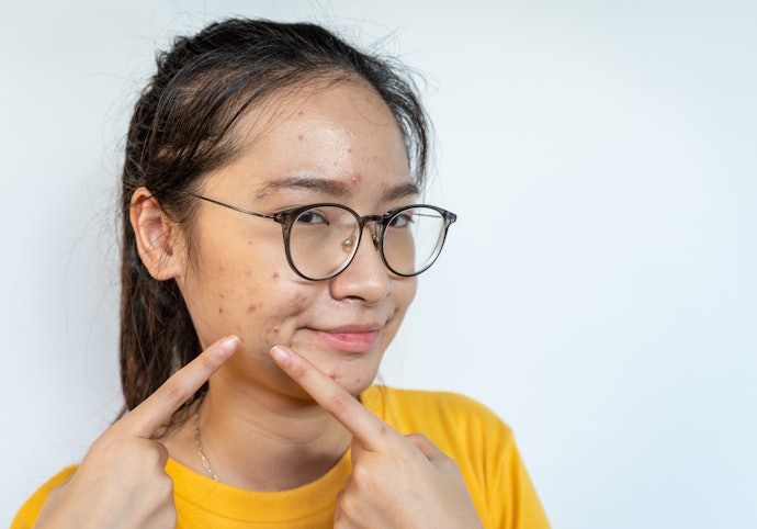 Untuk kulit berminyak dan berjerawat, prioritaskan untuk memilih produk yang mengandung salicylic acid atau tea tree oil serta berlabel non comedogenic