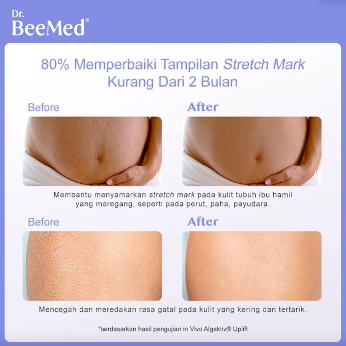 Untuk ibu hamil dan menyusui, pastikan tidak mengandung retinoid
