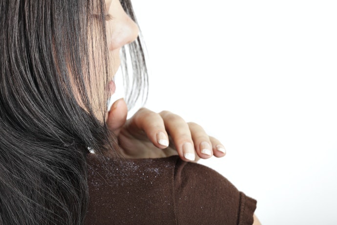 Rambut berketombe, membutuhkan kandungan antiketombe seperti zinc pyrithione atau piroctone olamine