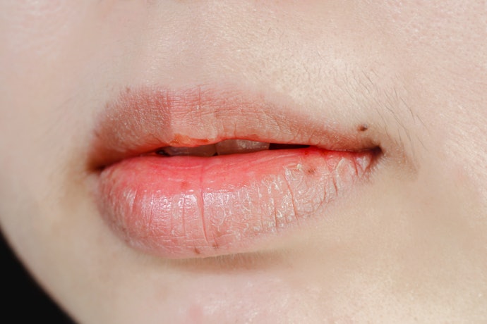 Bibir kering atau sensitif: Pilih lip scrub dengan eksfoliator kimia seperti AHA