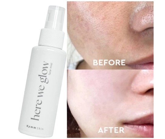 Untuk mendapatkan efek mencerahkan: Pilih face mist dengan niacinamide