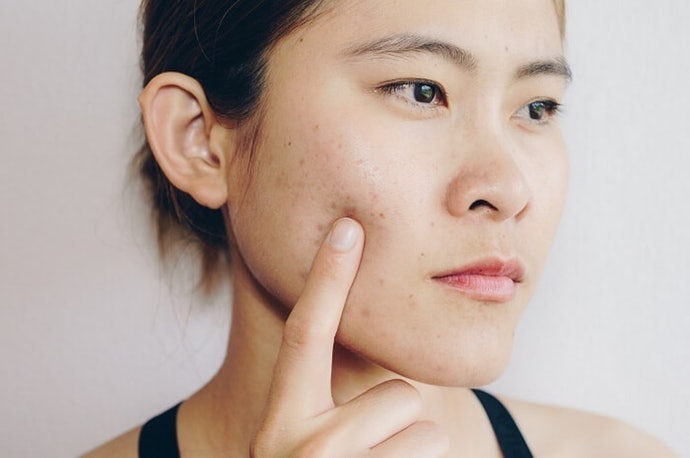 Untuk kulit berjerawat: Foundation dengan kandungan non-comedogenic