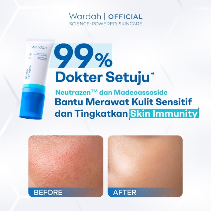 Untuk kulit kombinasi, normal, atau sensitif: Pilih moisturizer lotion yang lembut dan ringan